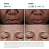 skinceuticals cell cycle catalyst-before and after-skinceuticals canada