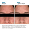 Clear Daily Soothing UV Defense Sunscreen SPF 50-before after