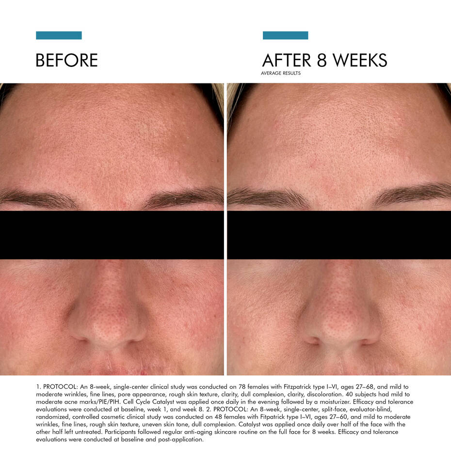 Clear Daily Soothing UV Defense Sunscreen SPF 50-before after