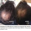 Cebelia Anti-Hair Loss Lotion-before and after result
