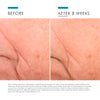 skinceuticals triple lipid restore-skinceuticals moisturizer-before and after