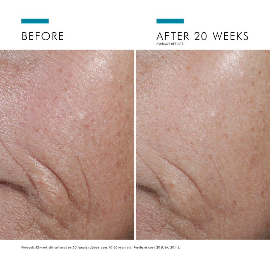 SkinCeuticals C E Ferulic-skinceuticals toronto-before and after