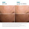 skinceuticals discoloration defense-before and after